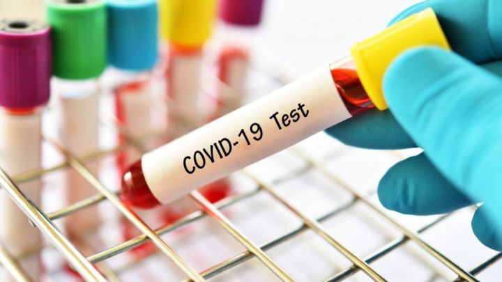 Azərbaycanda koronavirus ilə bağlı son vəziyyət açıqlandı