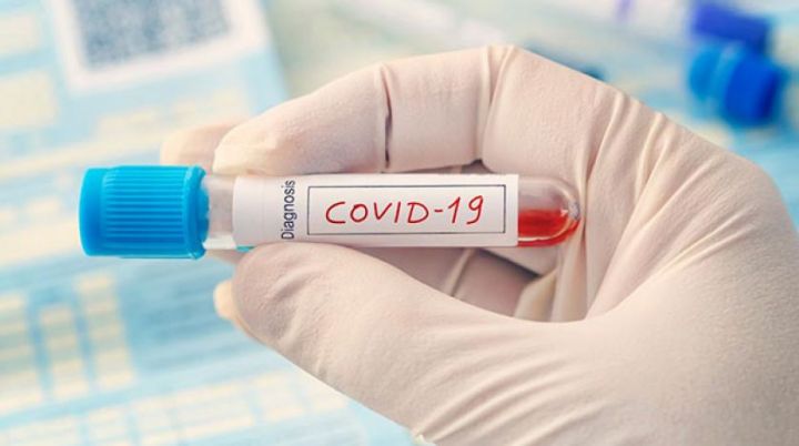 Azərbaycanda koronavirus ilə bağlı son vəziyyət açıqlandı