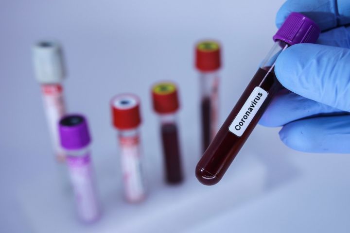 Azərbaycanda koronavirus ilə bağlı son vəziyyət açıqlandı