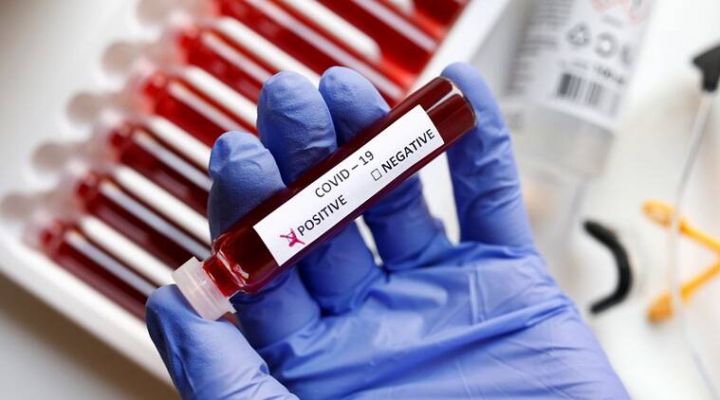 Azərbaycanda koronavirus ilə bağlı son vəziyyət açıqlandı